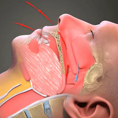 <strong>Stop Snoring</strong>